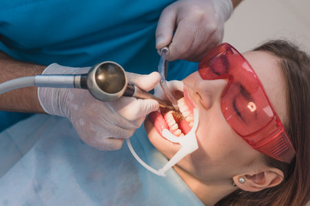 doctor performs the procedure for cleaning teethの写真素材