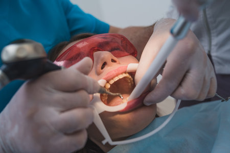doctor performs the procedure for cleaning teethの写真素材