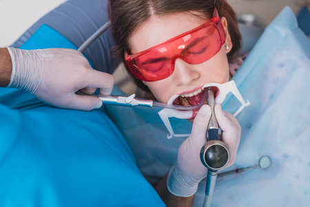 doctor performs the procedure for cleaning teethの写真素材