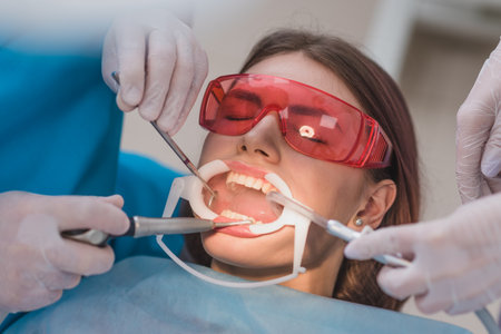 doctor performs the procedure for cleaning teethの写真素材