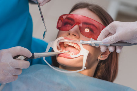 doctor performs the procedure for cleaning teethの写真素材