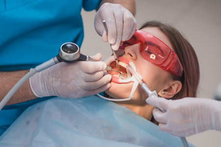 doctor performs the procedure for cleaning teethの写真素材