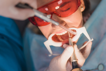 doctor performs the procedure for cleaning teethの写真素材