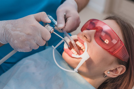 doctor performs the procedure for cleaning teethの写真素材