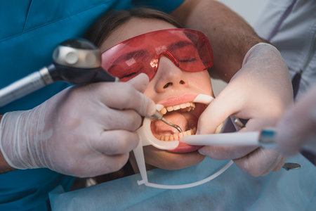 doctor performs the procedure for cleaning teethの写真素材