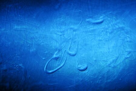 scientific photograph of parasites in human blood plasma under a microscope in a laboratory. soap solution in water.の写真素材