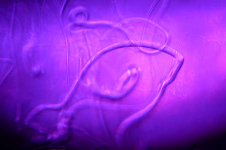 scientific photograph of parasites in human blood plasma under a microscope in a laboratory. soap solution in water.の写真素材