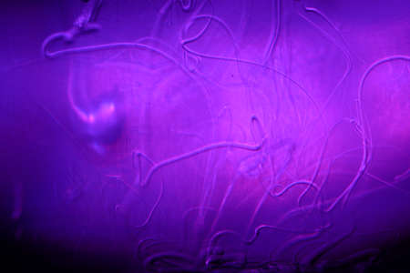 scientific photograph of parasites in human blood plasma under a microscope in a laboratory. soap solution in water.の写真素材