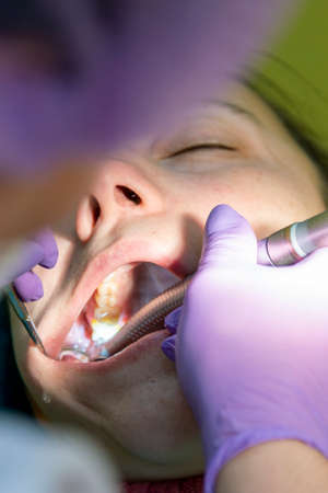 Male dentists examining and working on young female patient.Dentists office. Real woman in a chair at the dentist. toned. vertical photo. close upの写真素材