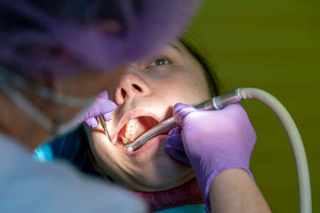 Male dentists examining and working on young female patient.Dentists office. Real woman in a chair at the dentist. close up. tonedの写真素材