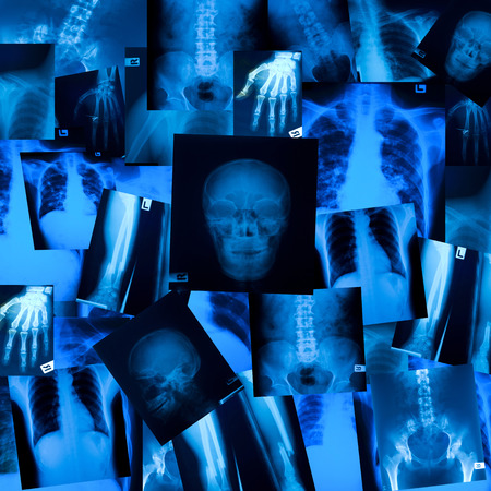 X ray film backgroundの写真素材