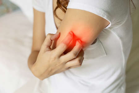 Woman itch hand arm and scratch and have problem with skin,Skincare Concept