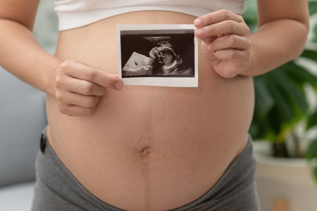 Close up Happy Pregnant Woman holding ultrasound image stroking big belly with love isolated on couch,Pregnancy of young woman enjoy with future life,Motherhood and Pregnant Conceptの写真素材