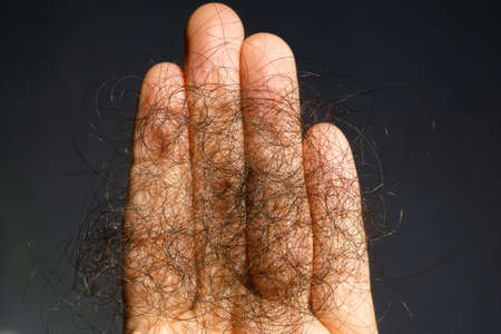 hair loss concept hand holding hair      men woman alopeciaの写真素材