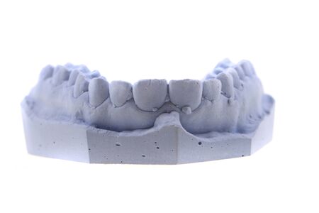 teeth gypsum model isolated on the white background