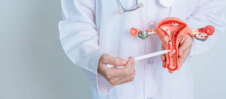 Doctor holding Uterus and Ovaries model. Ovarian and Cervical cancer, Cervix disorder,...