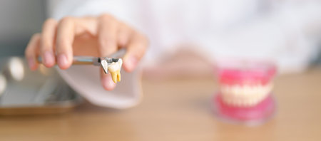 Dentist with tooth Anatomy model. Oral Teeth and disease, Scrape off tartar. March Oral health, Dentist Day, False Teeth. Toothache and Children Dental Health Month and Orthodontic Health Dayの写真素材