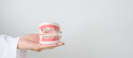 Dentist with Orthodontic tooth model and bracket or brace. Clean and Scrape off tartar. May Orthodontic Health Day, March Oral health, Dentist Day, False Teeth. Toothache and Children Dental Healthの写真素材