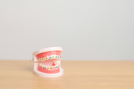Orthodontic tooth model and bracket or brace. Clean and Scrape off tartar. May Orthodontic Health Day, March Oral health, Dentist Day, False Teeth. Toothache and Children Dental Healthの写真素材