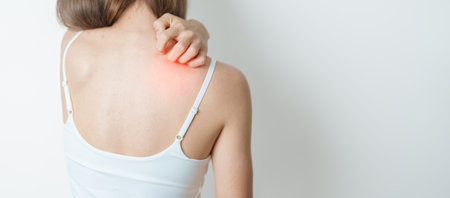 woman itching and scratching itchy back. Sensitive Skin Allergic reaction to insect bite, food, drug...