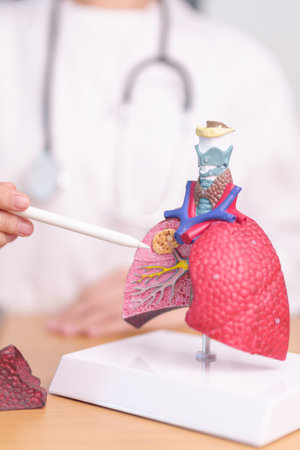 Doctor with Smoker and normal Lung anatomy for Disease. Lung Cancer, Asthma, Chronic Obstructive Pulmonary or COPD, Bronchitis, Emphysema, Cystic Fibrosis, Bronchiectasis, Pneumonia and world Lung dayの写真素材