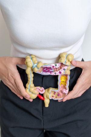 Woman holding human Colon anatomy model. Colonic disease, Large Intestine, Colorectal cancer,...