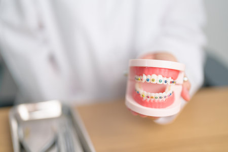 Dentist with Orthodontic tooth model and bracket or brace. Clean and Scrape off tartar. May Orthodontic Health Day, March Oral health, Dentist Day, False Teeth. Toothache and Children Dental Healthの写真素材