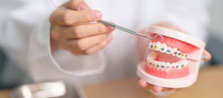Dentist with Orthodontic tooth model and bracket or brace. Clean and Scrape off tartar. May...