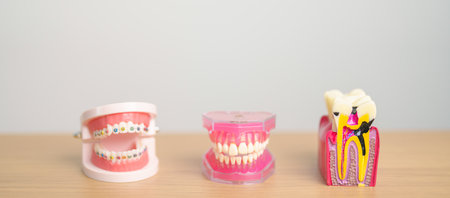 Tooth Anatomy and Orthodontic model on dentist table. Oral Teeth and disease. March Oral health, Dentist Day, False Teeth. Toothache and Children Dental Health Month and May Orthodontic Health Dayの写真素材