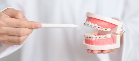 Dentist with Orthodontic tooth model and bracket or brace. Clean and Scrape off tartar. May Orthodontic Health Day, March Oral health, Dentist Day, False Teeth. Toothache and Children Dental Healthの写真素材