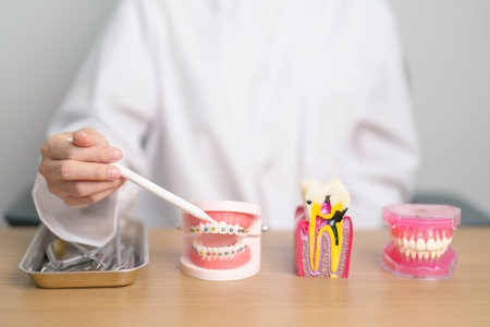 Tooth Anatomy and Orthodontic model on dentist table. Oral Teeth and disease. March Oral health, Dentist Day, False Teeth. Toothache and Children Dental Health Month and May Orthodontic Health Dayの写真素材