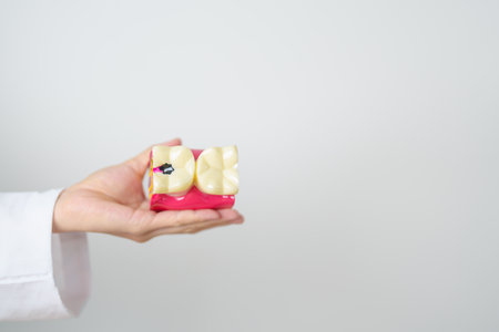Dentist with tooth Anatomy model. Oral Teeth decay and disease, Scrape off tartar. March Oral health, Dentist Day, False Teeth. Toothache and Children Dental Health Month and Orthodontic Health Dayの写真素材