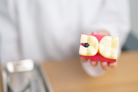 Dentist with tooth Anatomy model. Oral Teeth decay and disease, Scrape off tartar. March Oral...