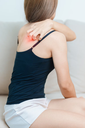 woman itching and scratching itchy back. Sensitive Skin Allergic reaction to insect bite, food, drug dermatitis. Dermatology, Leprosy, Systemic lupus erythematosus, Allergy symptoms and rash Eczemaの写真素材