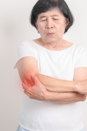 Elderly Woman having elbow ache for concepts of Tennis Elbow, muscle pain, lateral epicondylitis, Bursitis, injury, Office syndrome, Senior Health care and medicalの写真素材