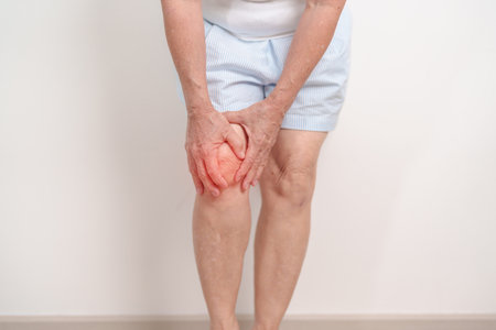 Elderly woman having knee ache and muscle pain due to Runners Knee or Patellofemoral Pain Syndrome, osteoarthritis, arthritis, rheumatism and Patellar Tendinitis. Senior health and medical conceptの写真素材