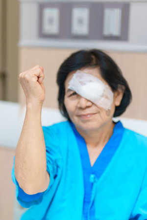 Elderly Woman with eye protective shield after eye surgery. Eye disease, Cataract,  Glaucoma, Age...