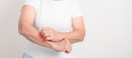 Elderly woman itching arm and body scratching for Skin Allergy from insect bite and food dermatitis.