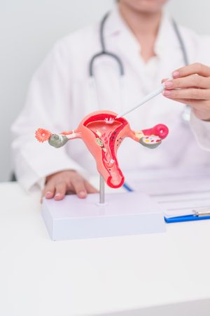 Woman patient consulting doctor with anatomy Uterus and Ovaries. Ovarian and Cervical cancer, Cervix disorder, Endometriosis, Hysterectomy, Uterine fibroids, Reproductive system and Pregnancy conceptの写真素材