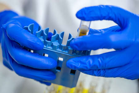medical test tube in hand in blue gloves.