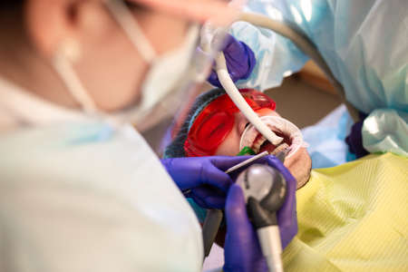 the process of dental treatment in dentistry.の写真素材