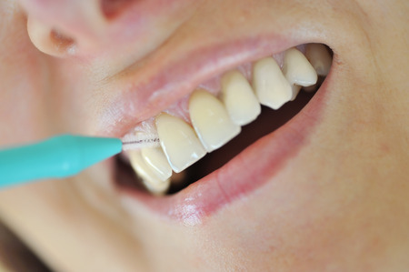 Interdental brush- Woman Cleaning Her Teethの写真素材
