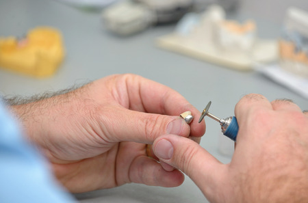 Dental technician working in dental laboratoryの写真素材