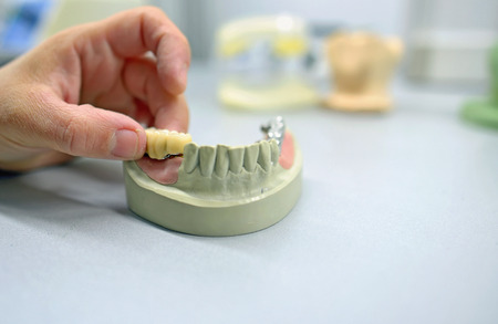 Dental technician working in dental laboratoryの写真素材