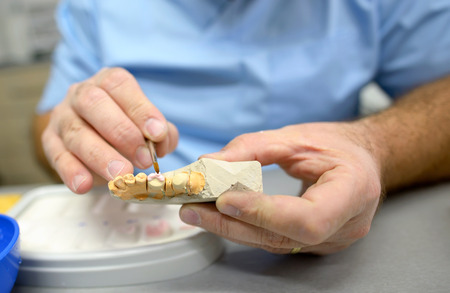 Dental technician working in dental laboratoryの写真素材