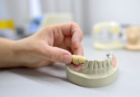 Closeup of dental technician workingの写真素材