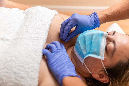 physiotherapist giving treatment with dry needling to patient on covid timeの写真素材