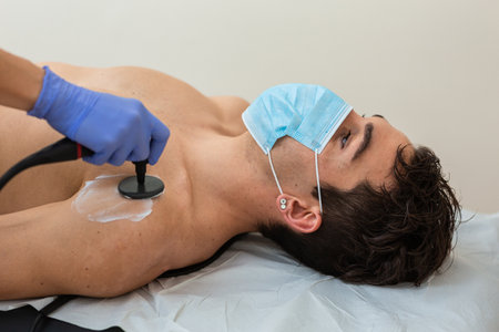 woman physiotherapist with mask does a diathermy to a man whith a chronic painの写真素材