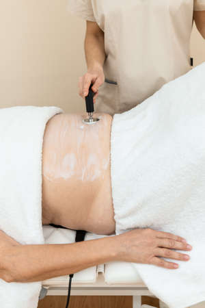 woman receiving treatment with radiofrequency machine for stimulationの写真素材