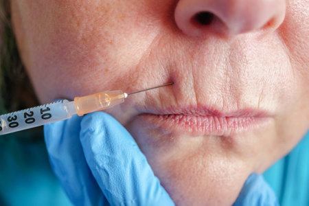 older woman injected into lips Hyaluronic acid ,Woman in beauty salon. plastic surgery clinicの写真素材